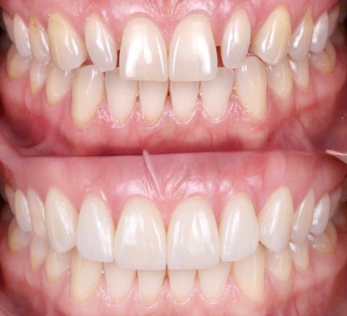 Risultato e Armonia Naturale